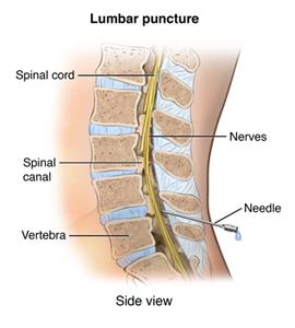 PNerv_20140304_v0_002 Lumbar puncture