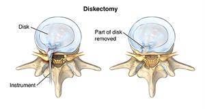 PNerv_20140108_v0_001 PNerv_20140108_v0_001